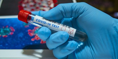 tratamiento datos respecto COVID-19